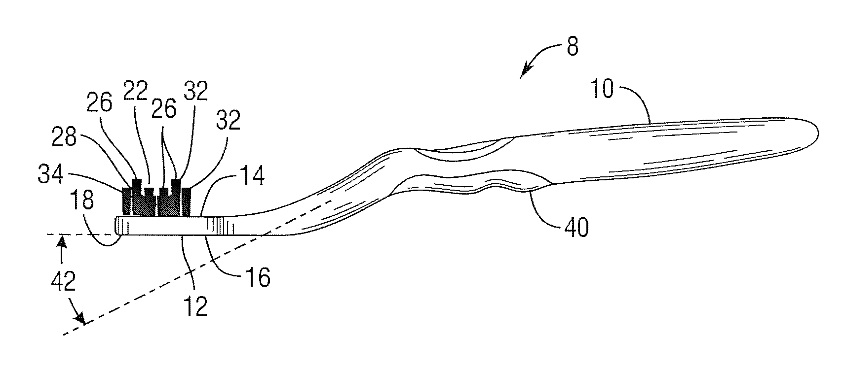 Orthodontic toothbrush