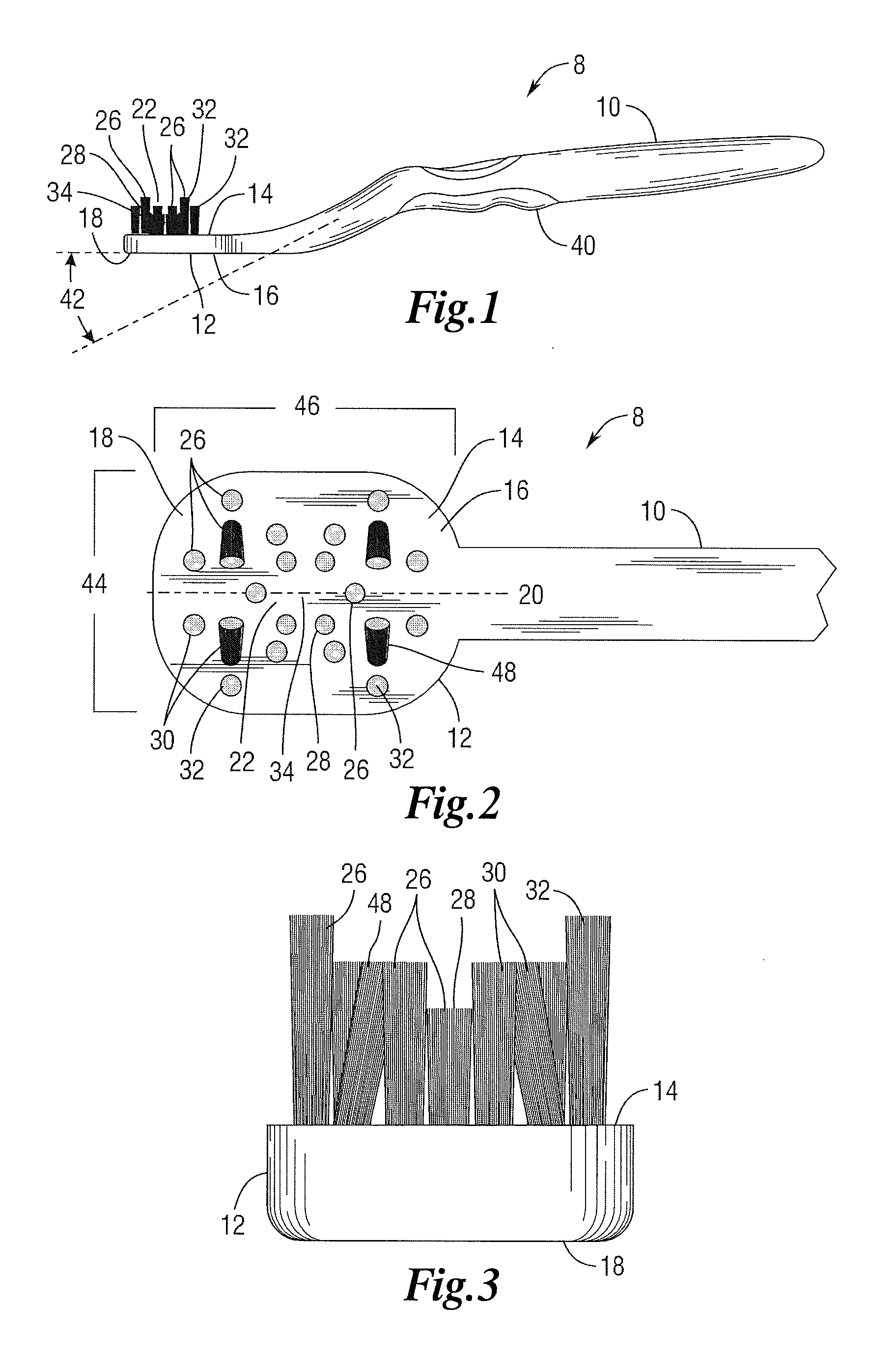 Orthodontic toothbrush