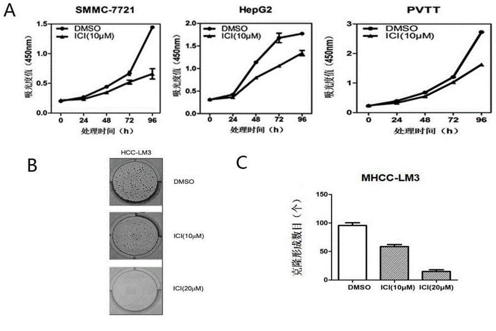 Application of ADRB2 inhibitor and sorafenib combination in preparation of medicine for treating liver cancer