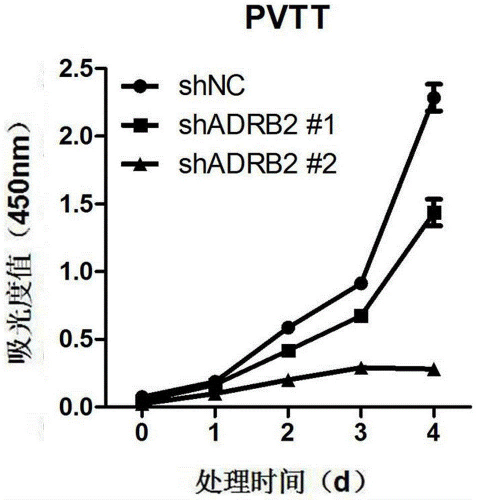 Application of ADRB2 inhibitor and sorafenib combination in preparation of medicine for treating liver cancer