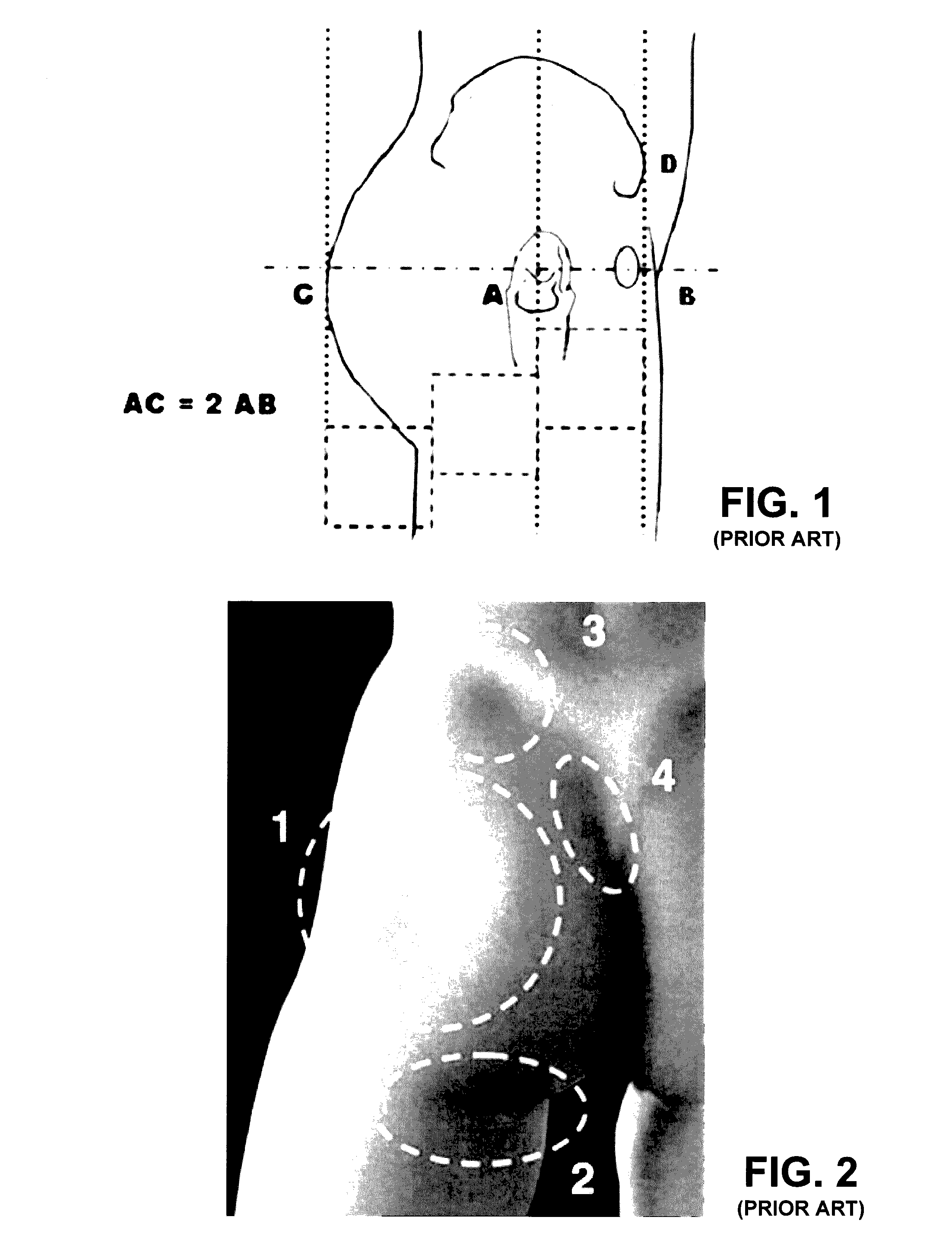 Anatomy shading for garments