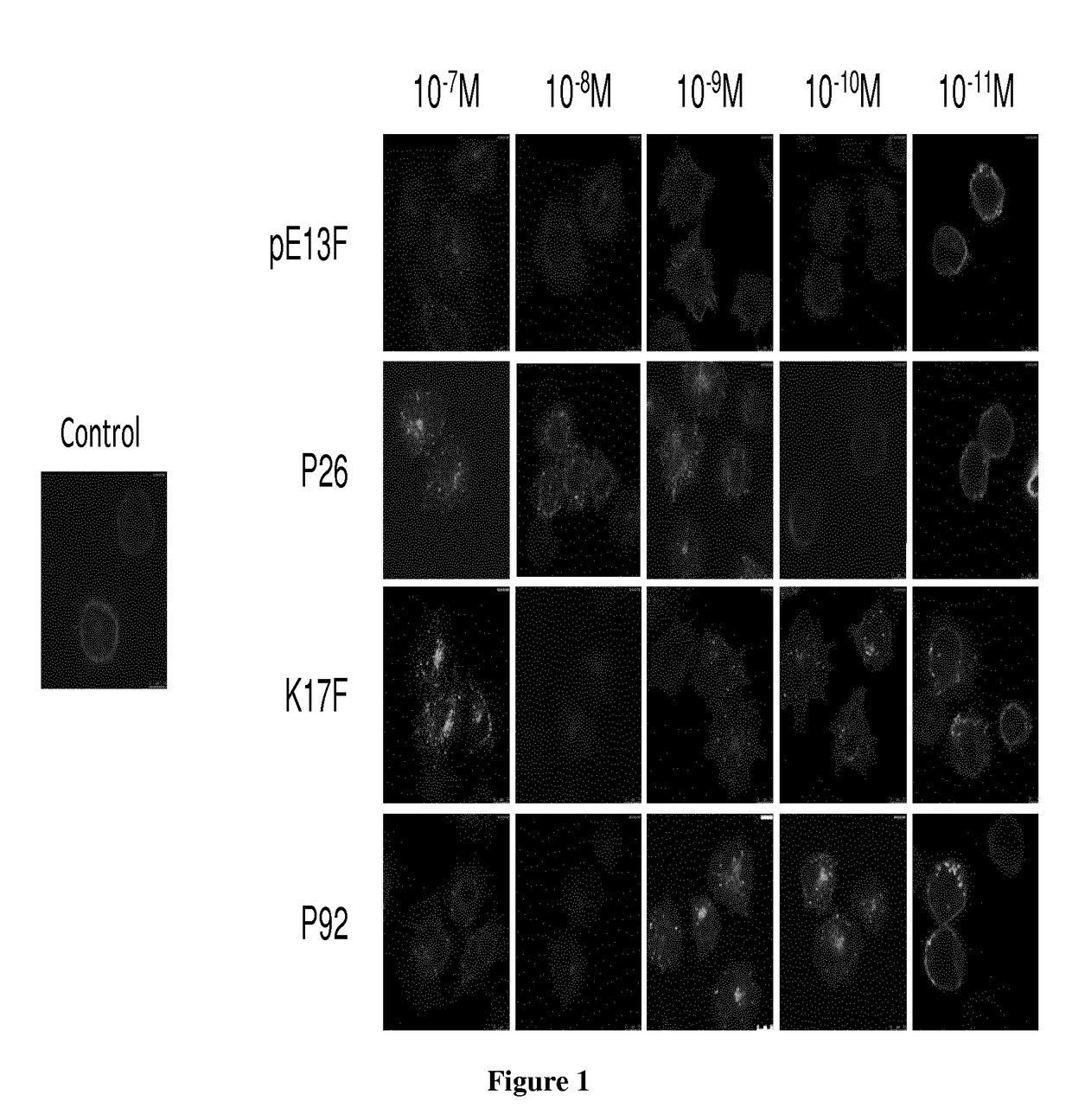 Metabolically Stable Apelin Analogs in the Treatment of Disease Mediated by the Apelin Receptor