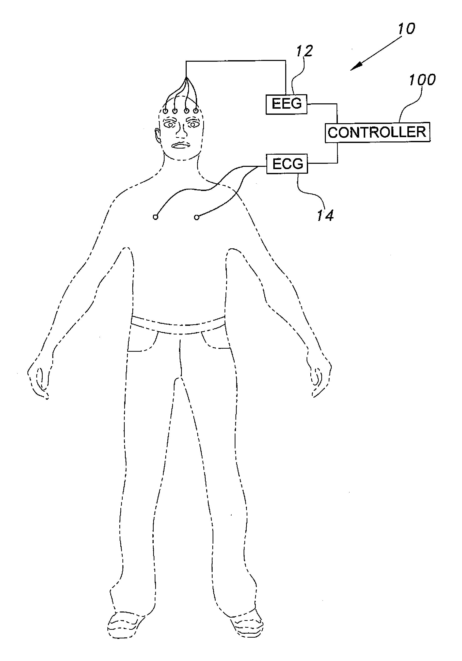 System and method for detecting seizure activity