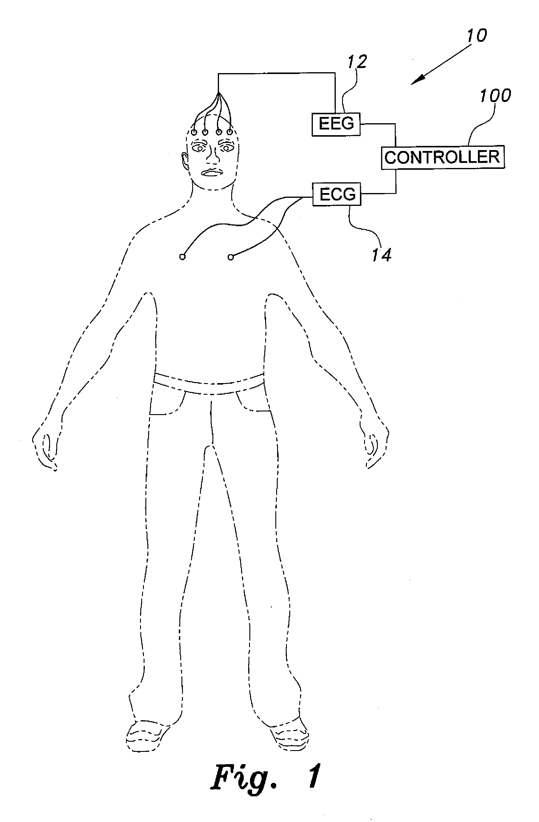 System and method for detecting seizure activity