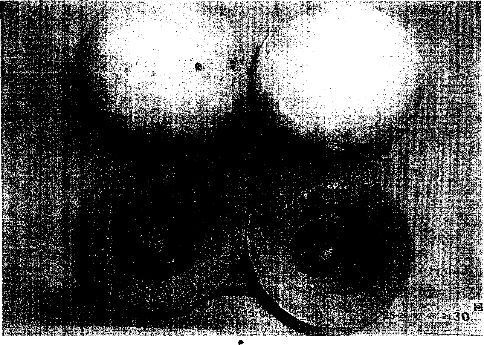 Method for producing resolvable hollow deformed foam aluminium alloy by secondary foaming