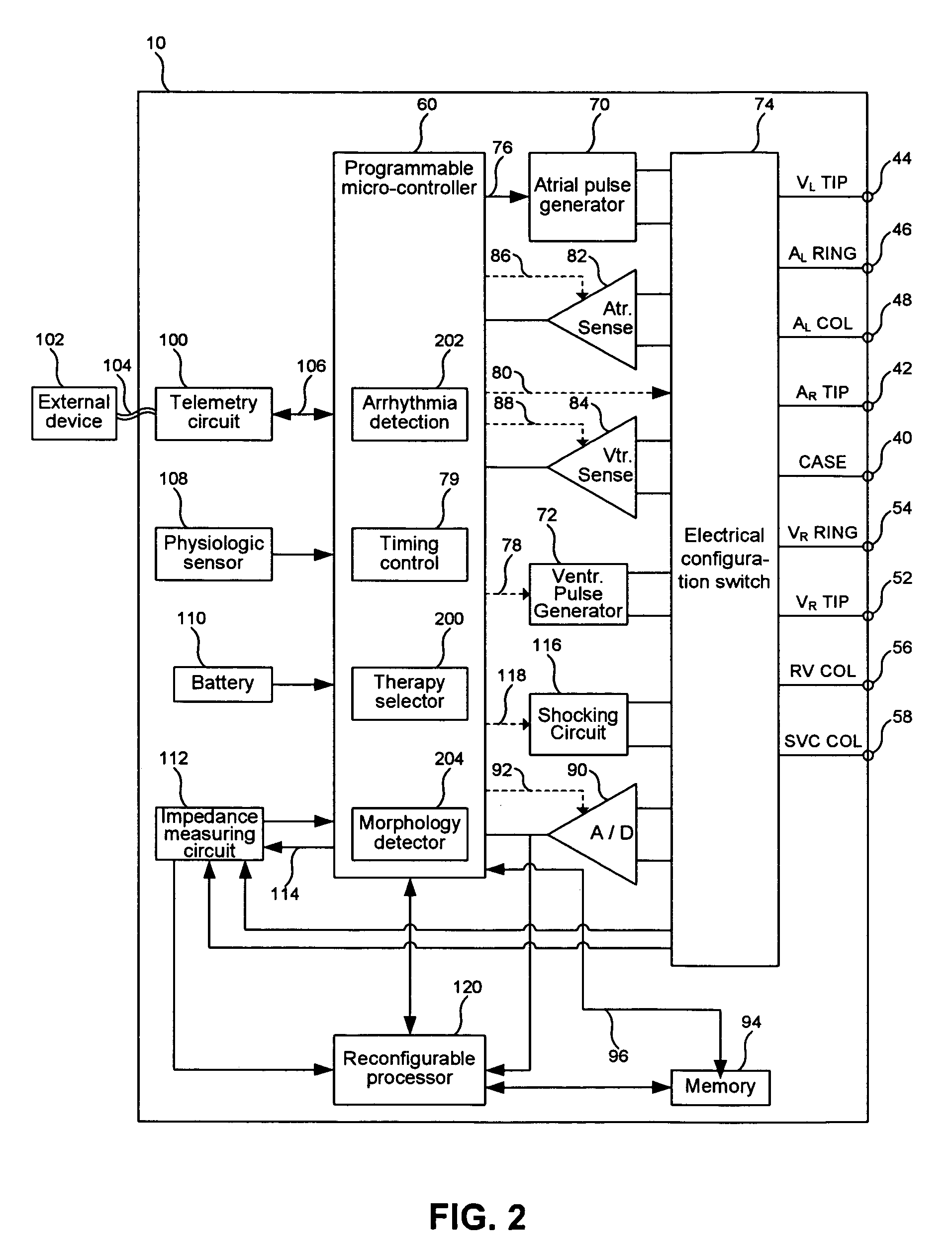 Reconfigurable digital network for processing data in an implantable medical device