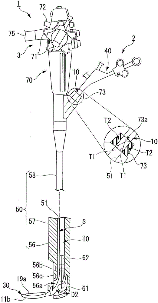 Treatment instrument for endoscope, and endoscope system