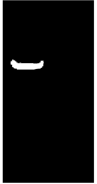 Recombinant protein HF2 used for methicillin-resistant staphylococcus aureus (MRSA) vaccine, and preparation method and application thereof