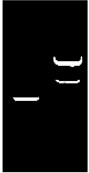 Recombinant protein HF2 used for methicillin-resistant staphylococcus aureus (MRSA) vaccine, and preparation method and application thereof