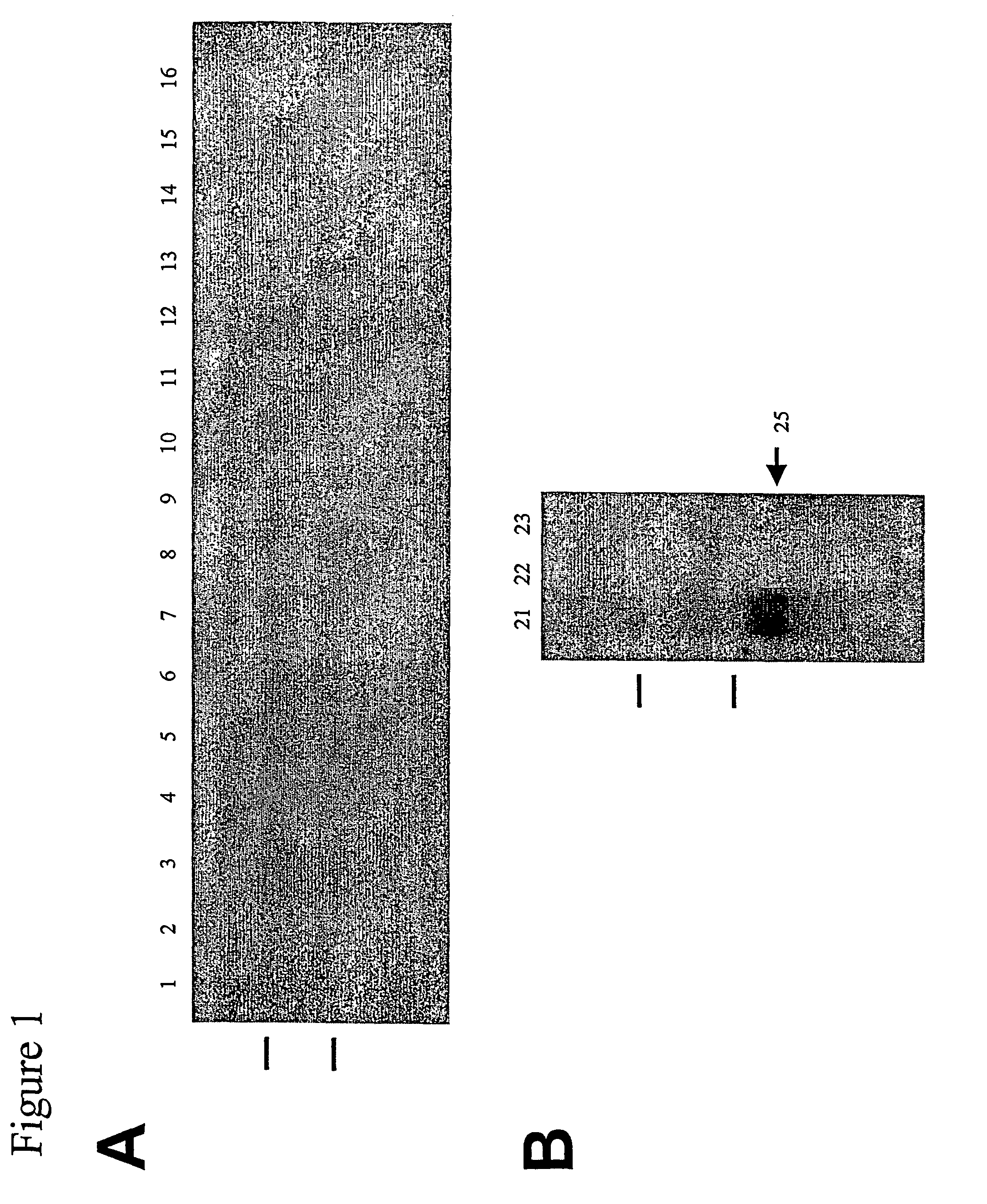 Bone polypeptide-1