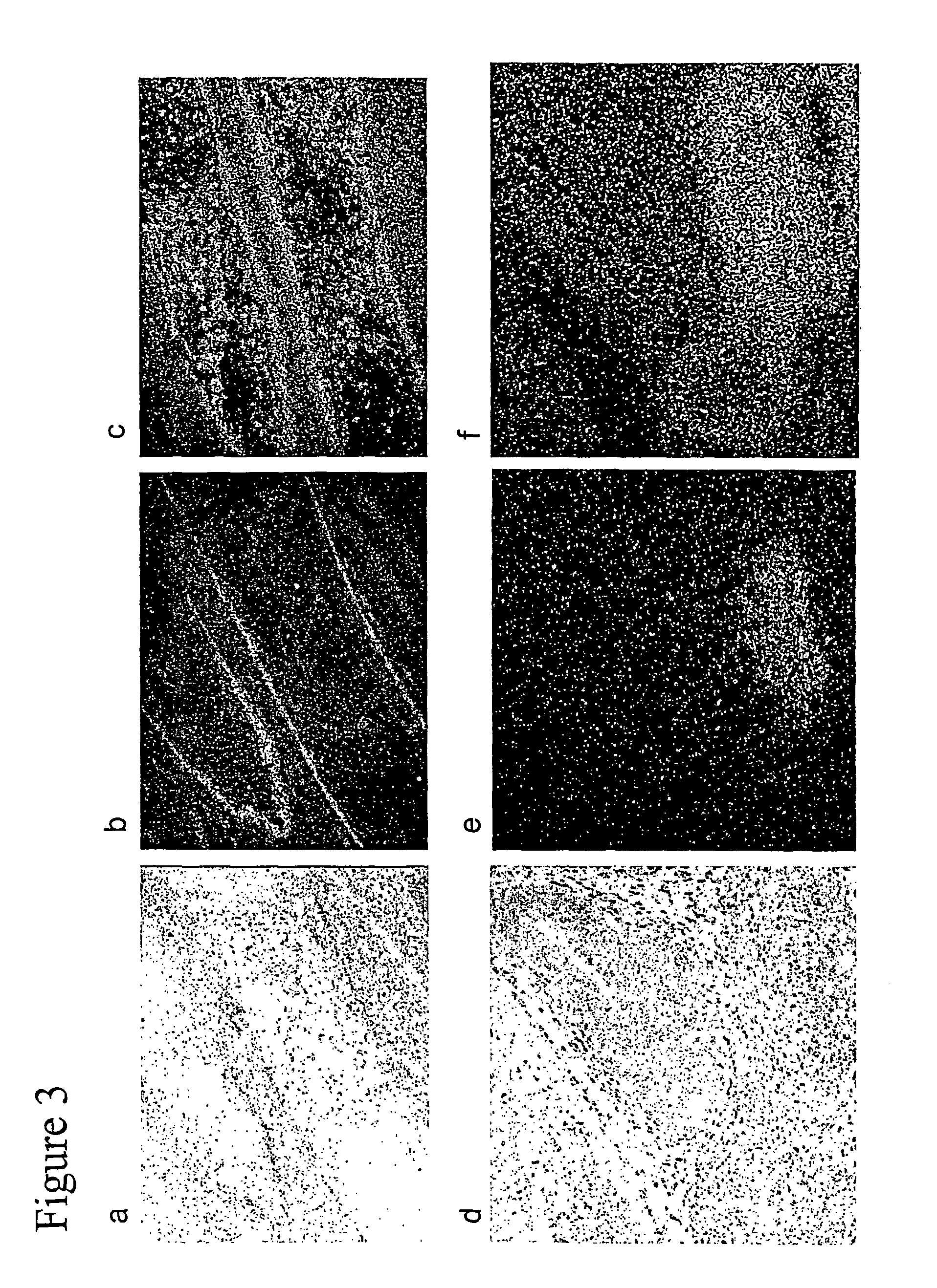 Bone polypeptide-1