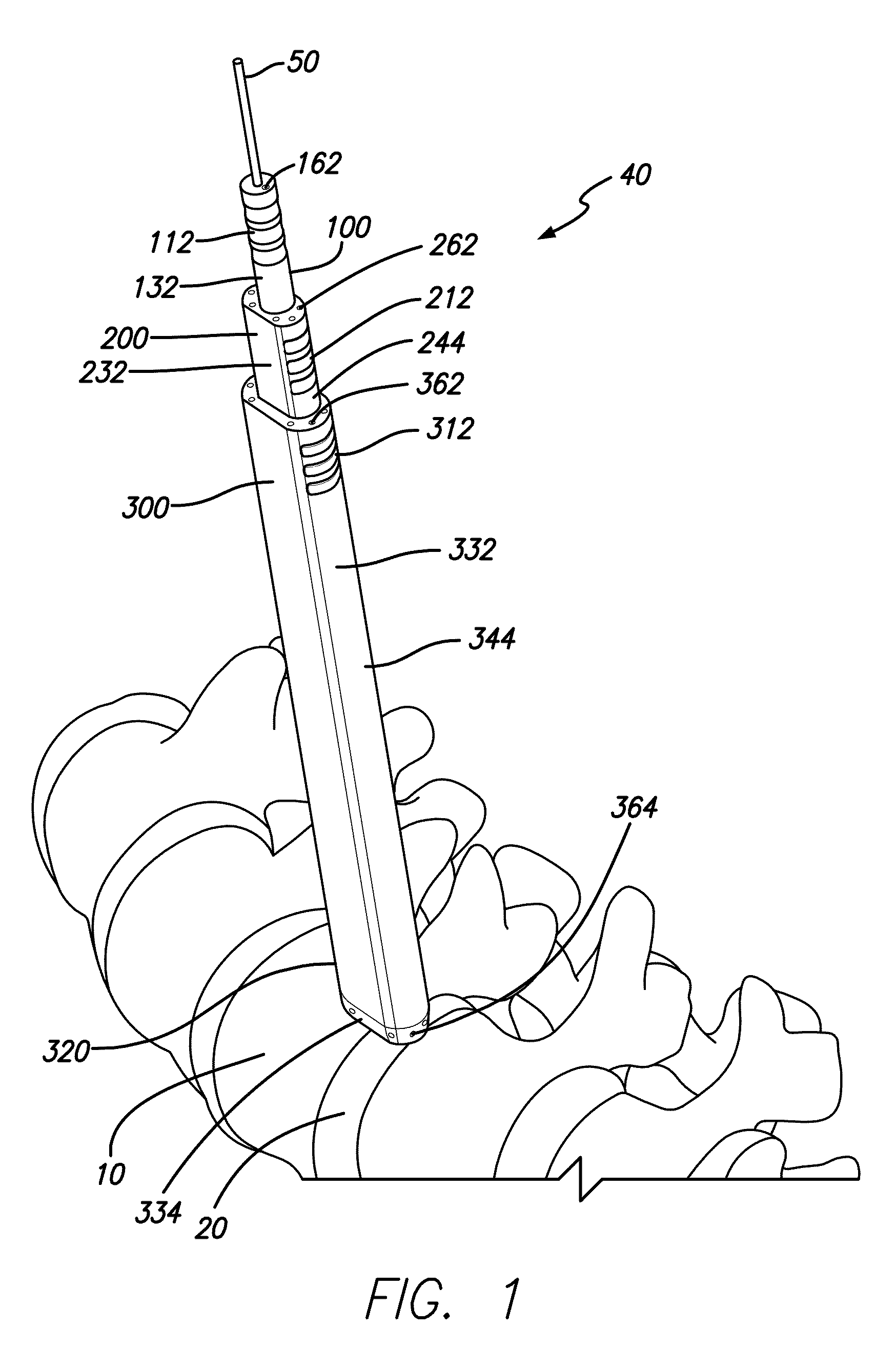 Tissue dilator and retractor system and method of use