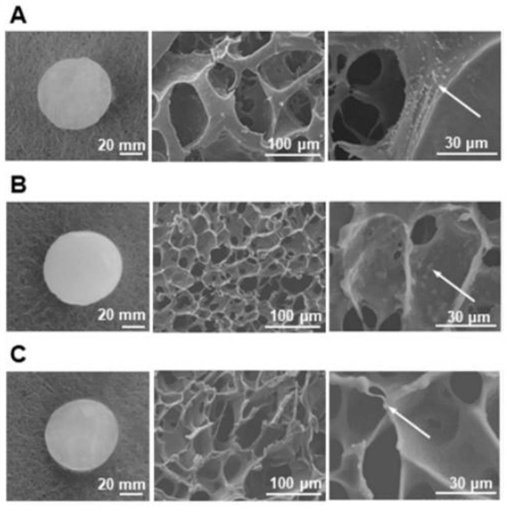 Antibiotic and hormone combined hydrogel capable of being locally injected as well as preparation method and application