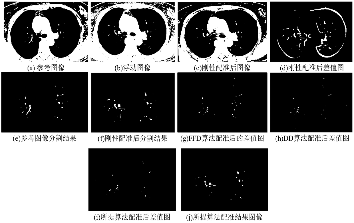 A medical image registration method based on super pixel guide