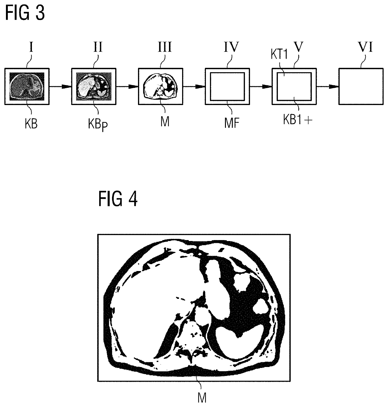 Method, computer and imaging apparatus