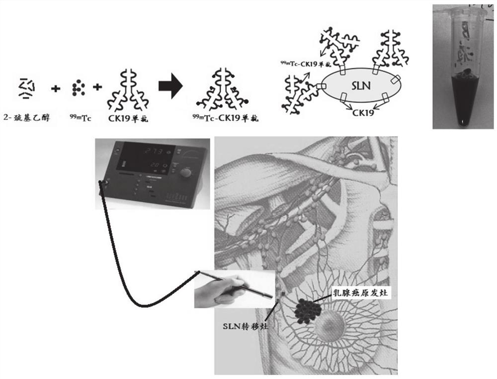 Radionuclide targeted breast cancer sentinel lymph node metastasis tracer and preparation method thereof