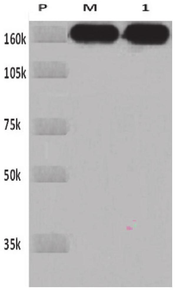 Radionuclide targeted breast cancer sentinel lymph node metastasis tracer and preparation method thereof