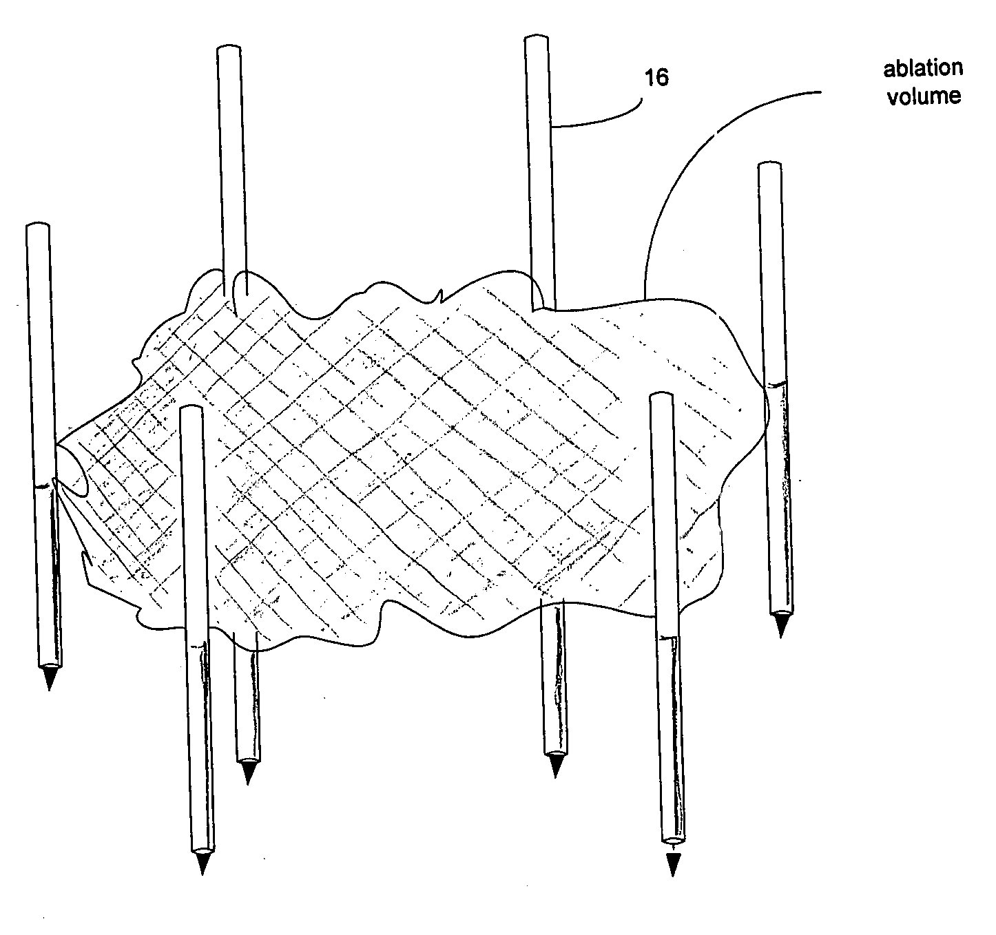 Methods and systems for treating fatty tissue sites using electroporation