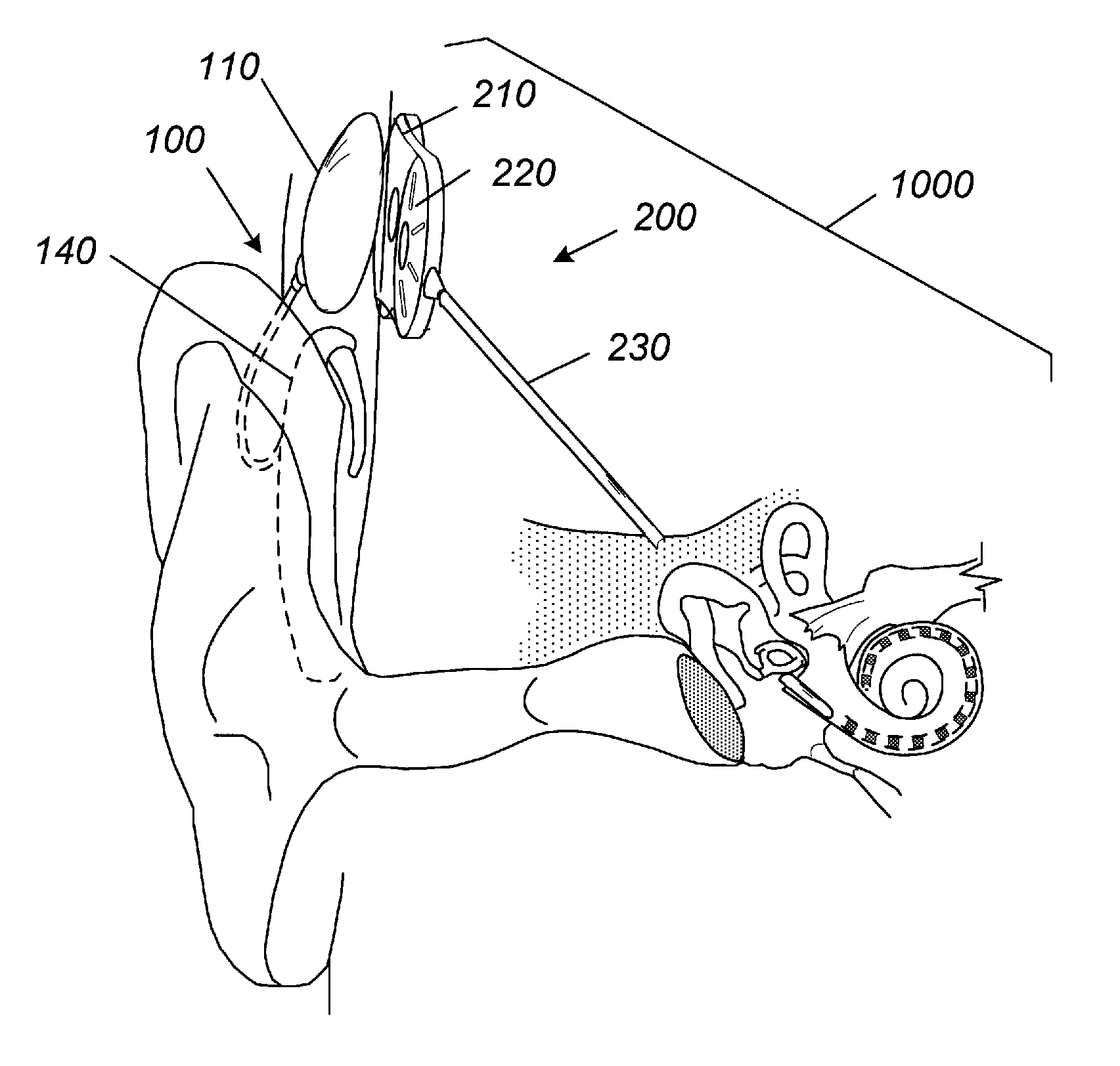 Waterproof acoustic element enclosures and apparatus including the same