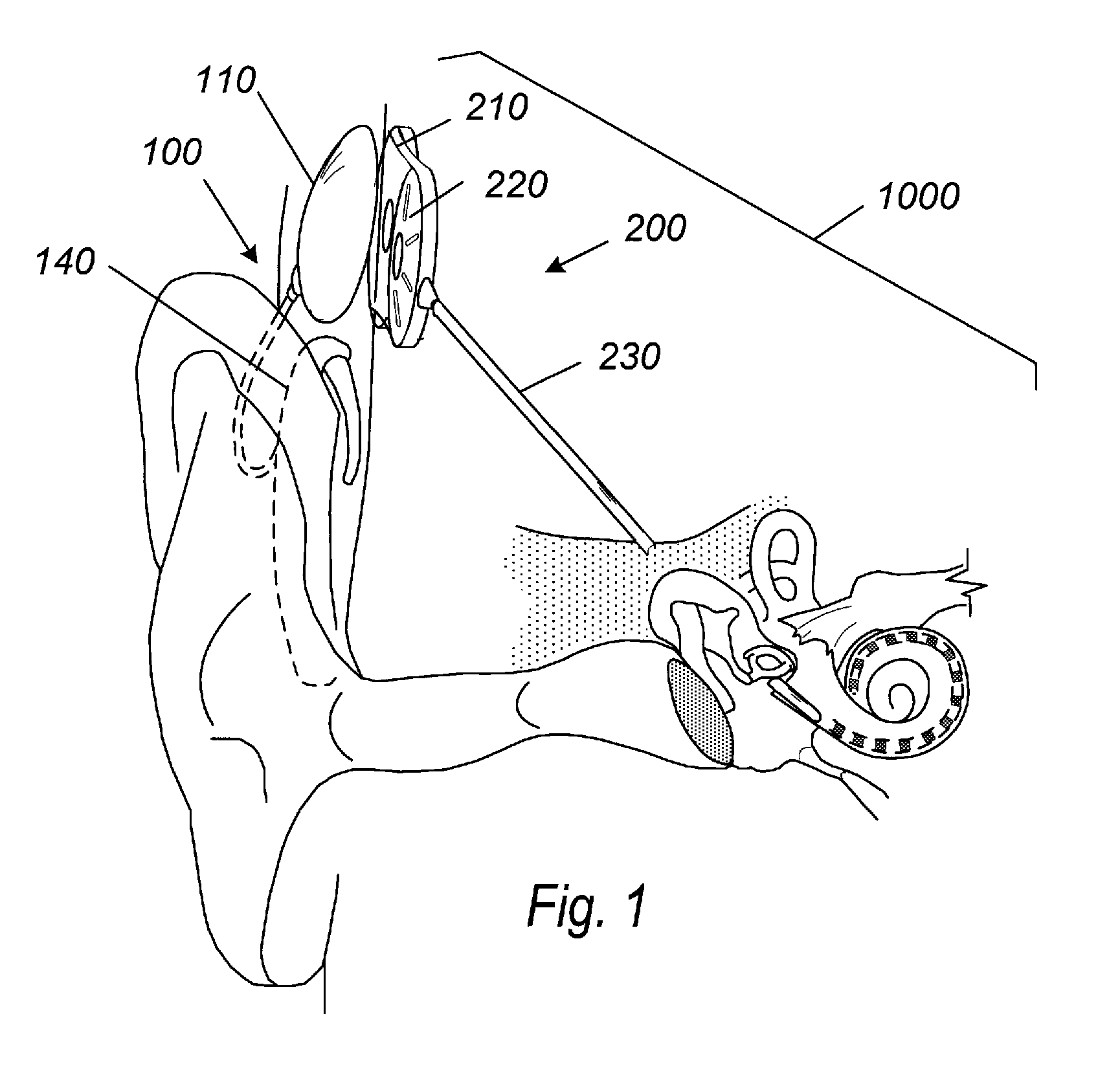 Waterproof acoustic element enclosures and apparatus including the same