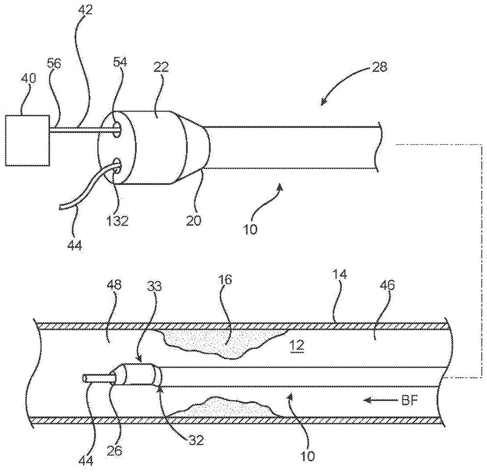 Microcatheter sensor design for minimizing profile and wire strain effects on the sensor