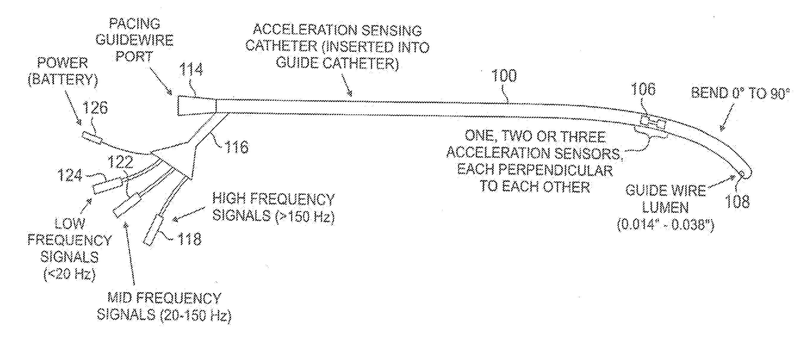 Accelerometer-based monitoring of the frequency dynamics of the isovolumic contraction phase and pathologic cardiac vibrations