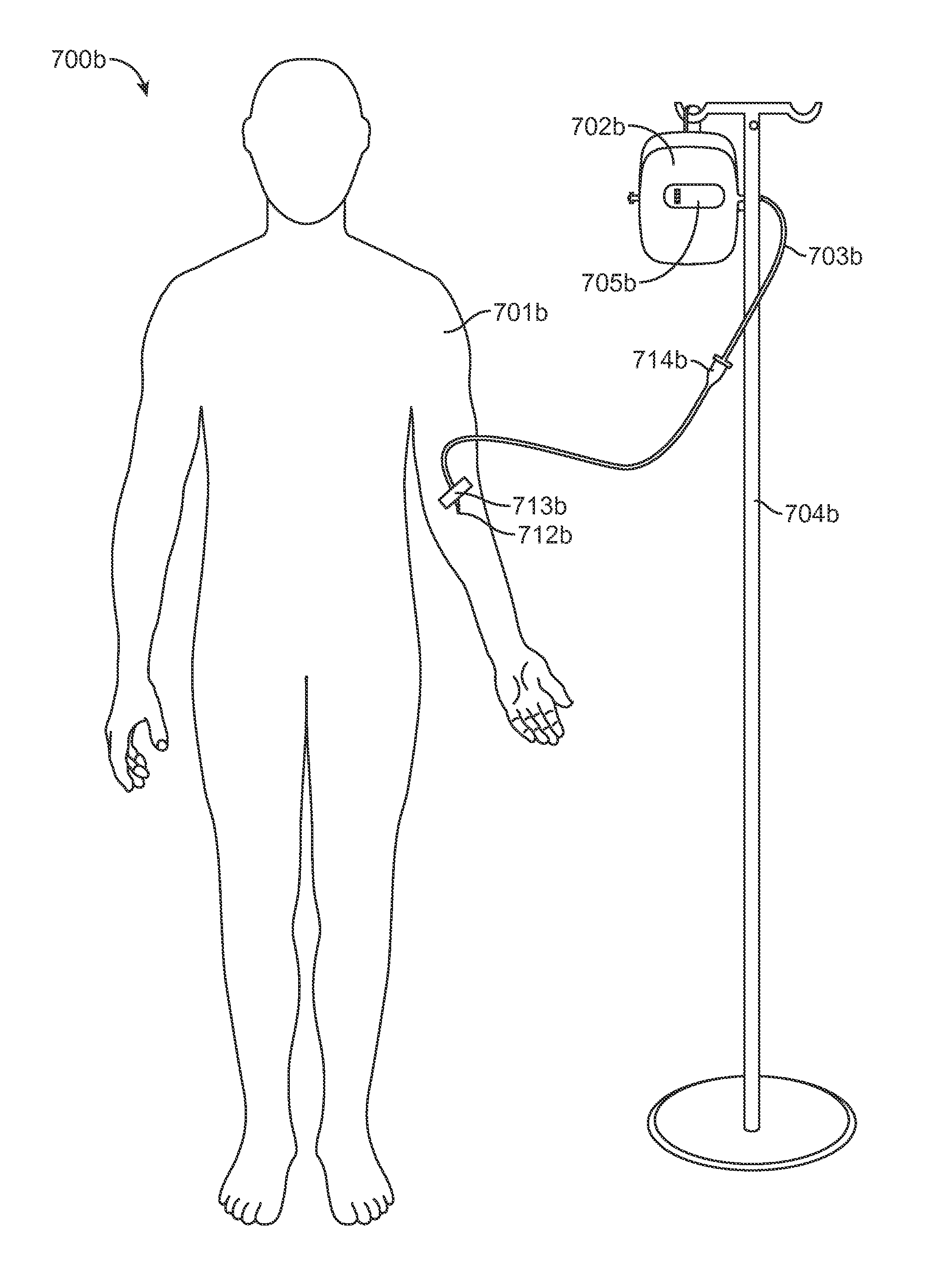 Infusion System for the Controlled Delivery of Therapeutic Agents