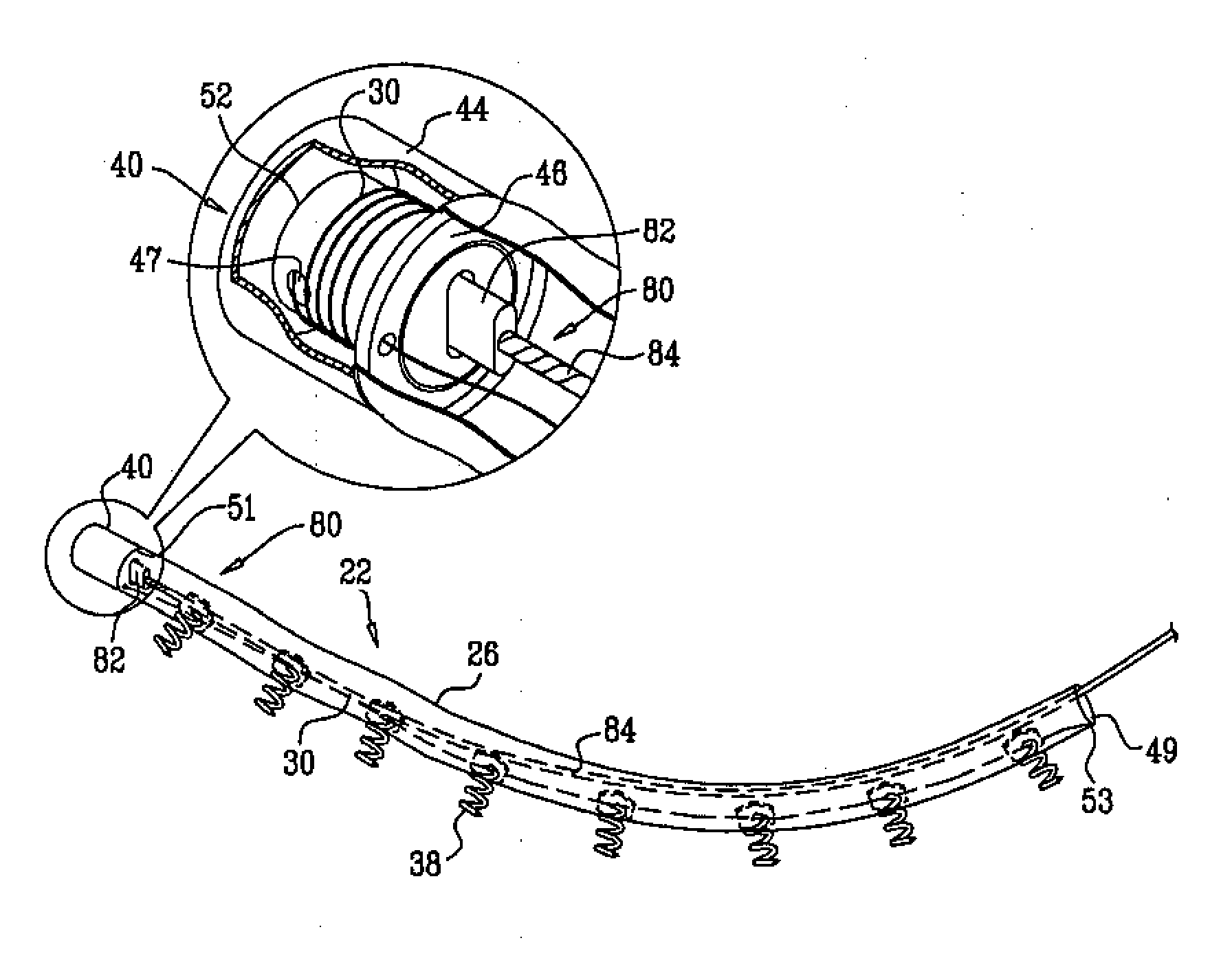 Deployment techniques for annuloplasty ring and over-wire rotation tool