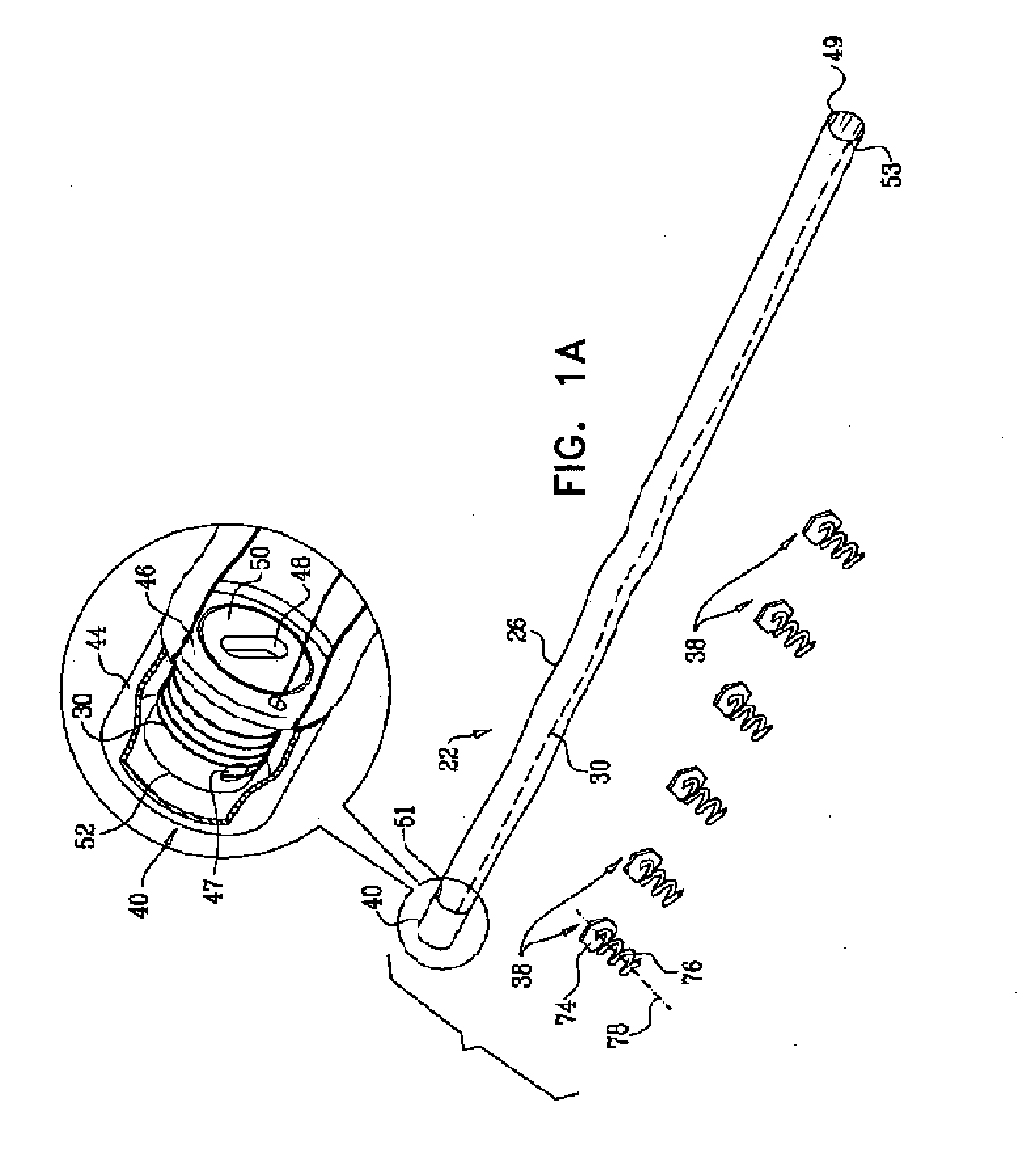 Deployment techniques for annuloplasty ring and over-wire rotation tool