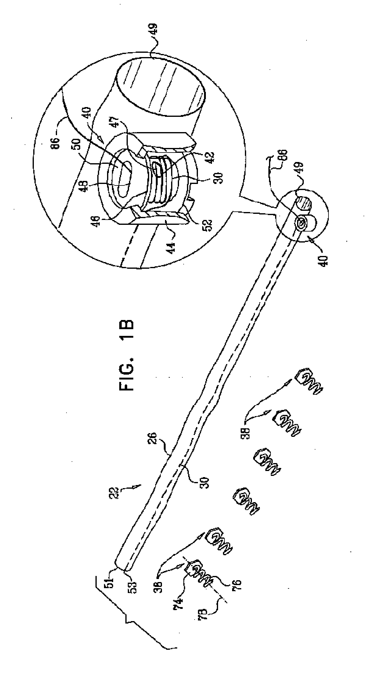 Deployment techniques for annuloplasty ring and over-wire rotation tool