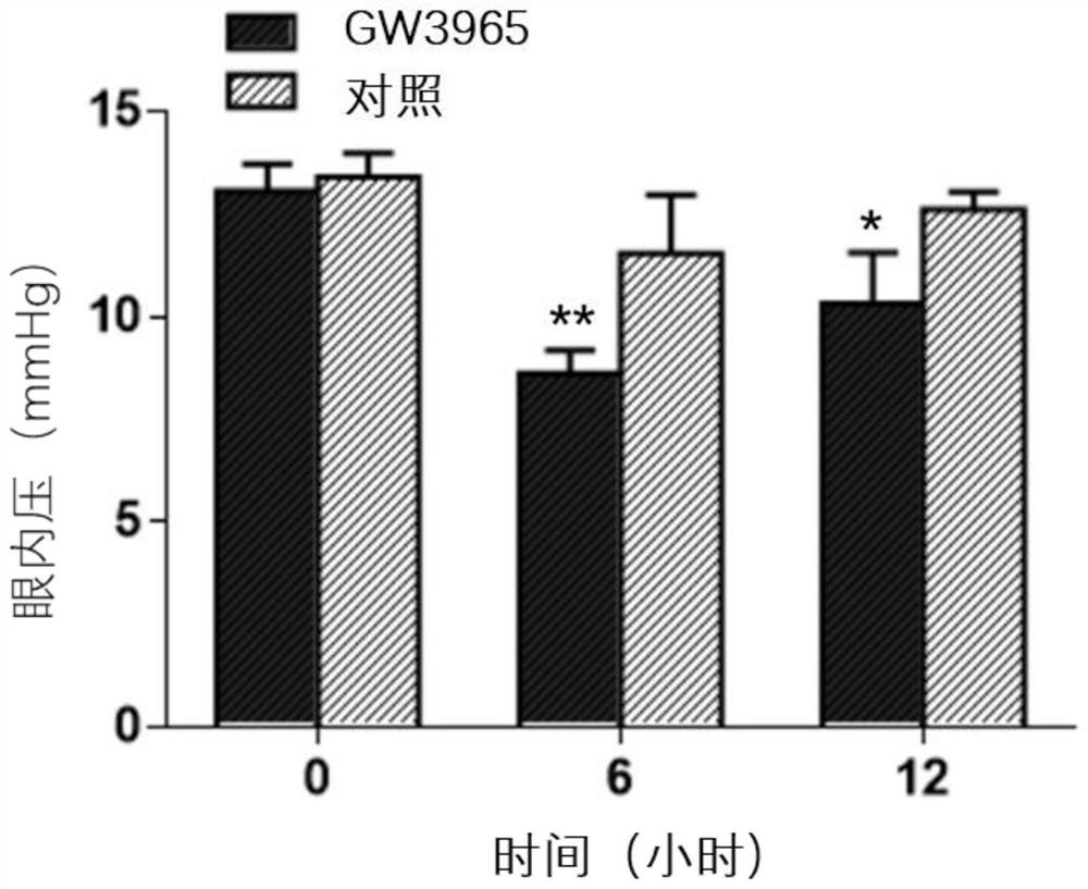 Use of abca1 agonist in the preparation of medicines for treating eye diseases