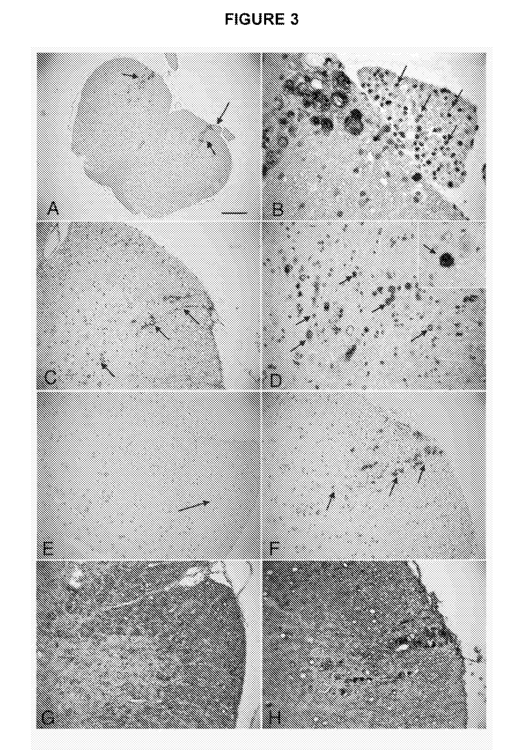 Methods and Compositions for Detecting Amyotrophic Lateral Sclerosis