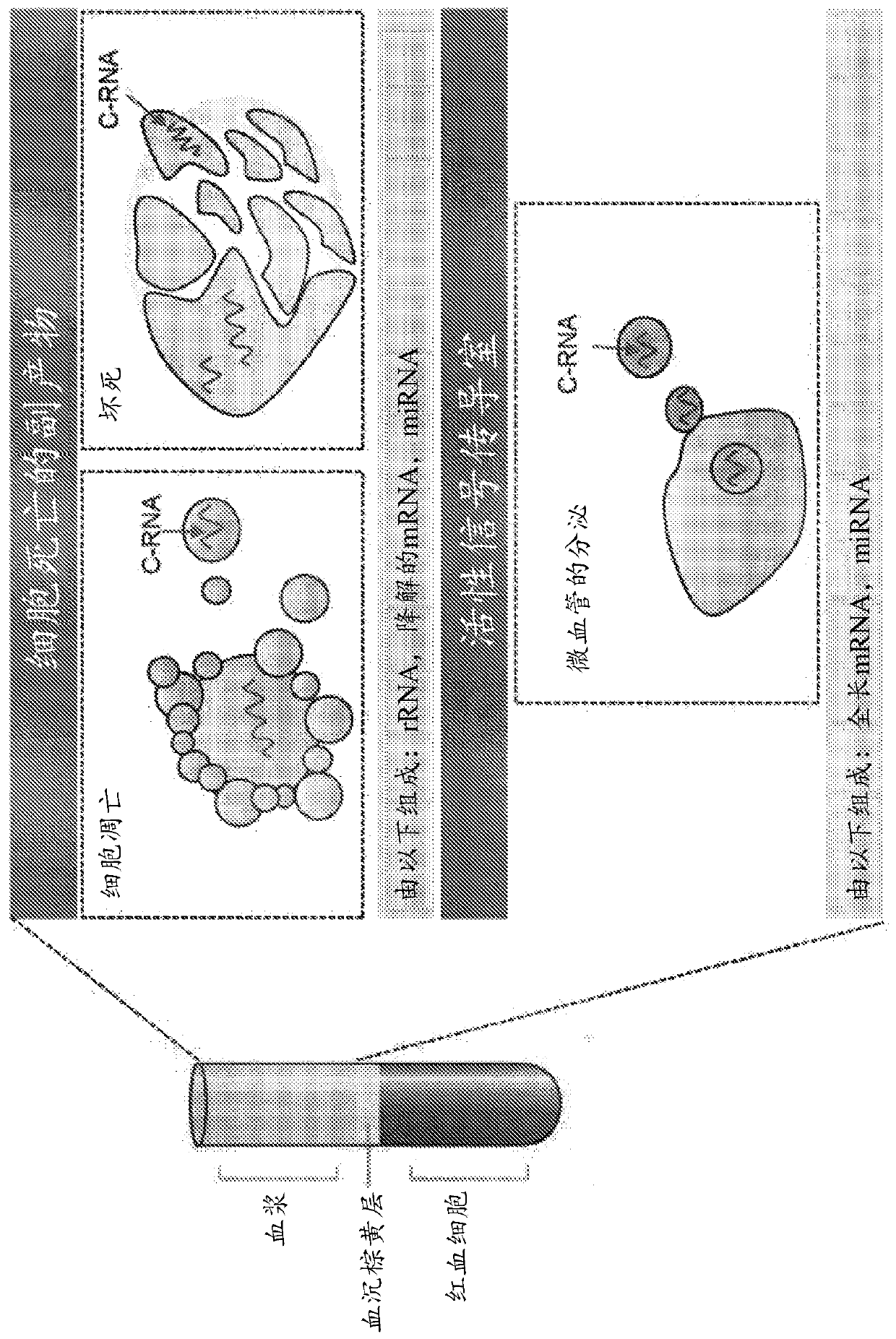 Circulating RNA signatures specific to preeclampsia