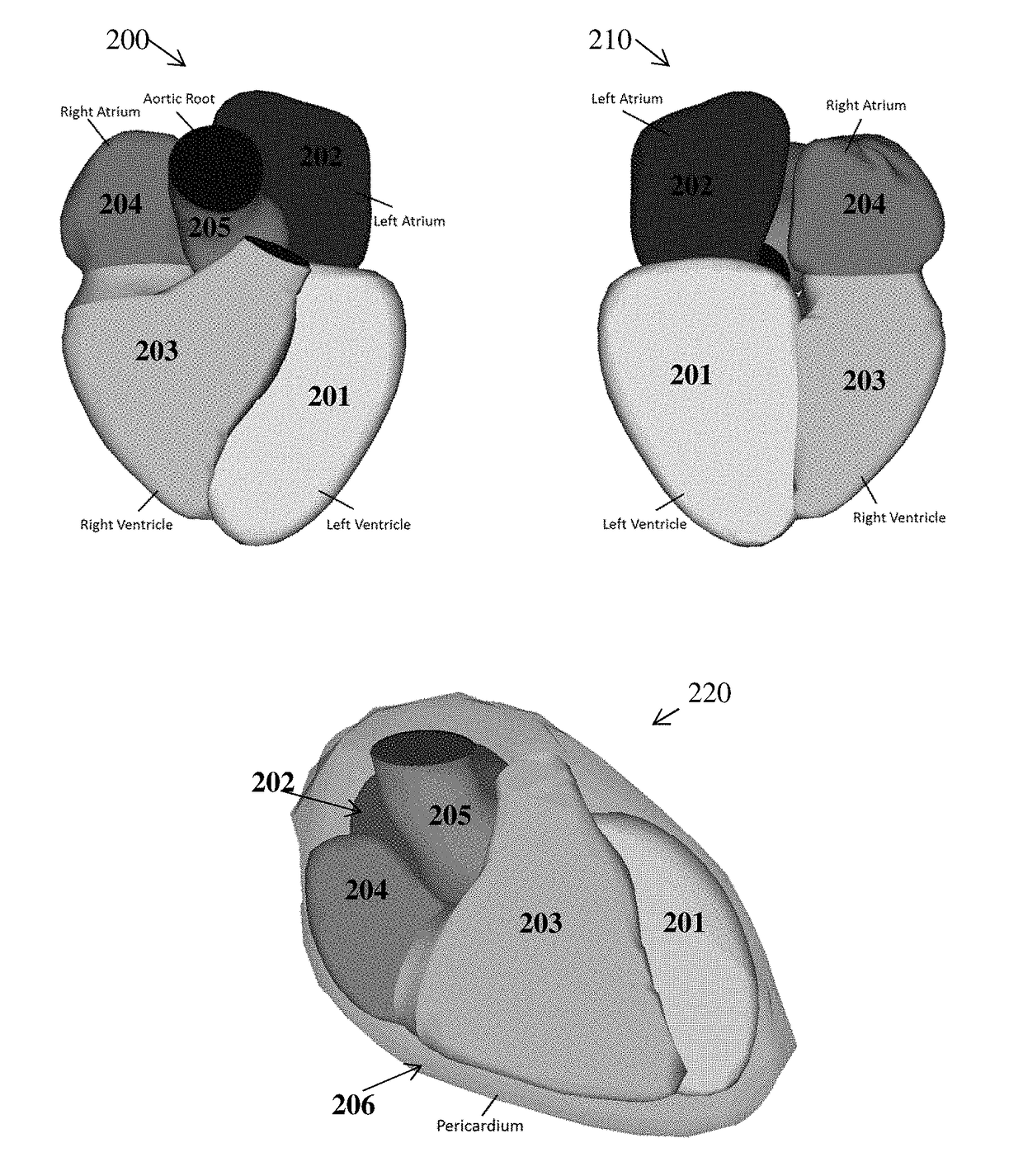 Method and System for Machine Learning Based Estimation of Anisotropic Vessel Orientation Tensor