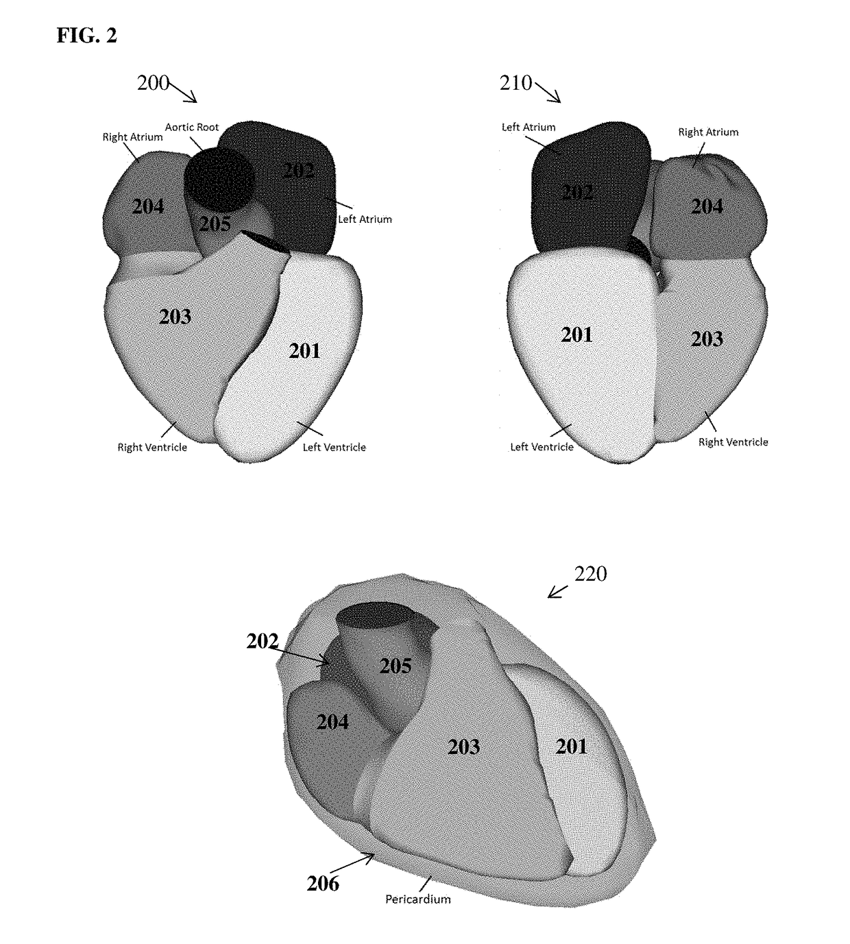 Method and System for Machine Learning Based Estimation of Anisotropic Vessel Orientation Tensor