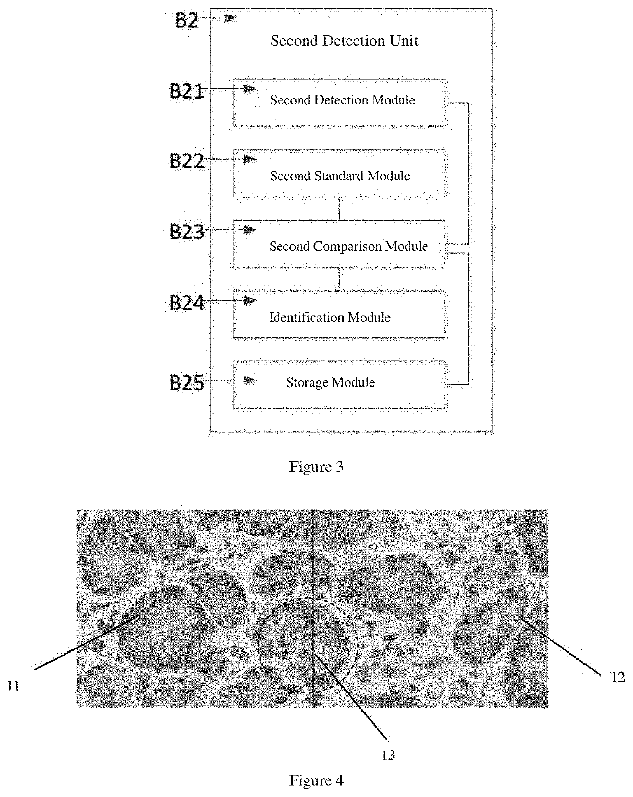 Digital pathological slide scanning system