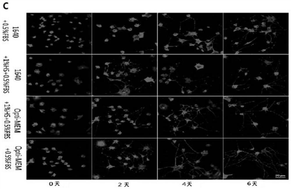 A method for inducing pc-12 cells to differentiate into neurons