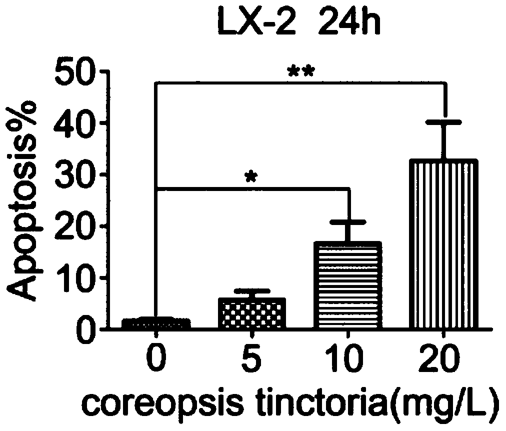 Application of snow chrysanthemum extract and total flavonoids of snow chrysanthemum in the preparation of drugs for treating liver fibrosis