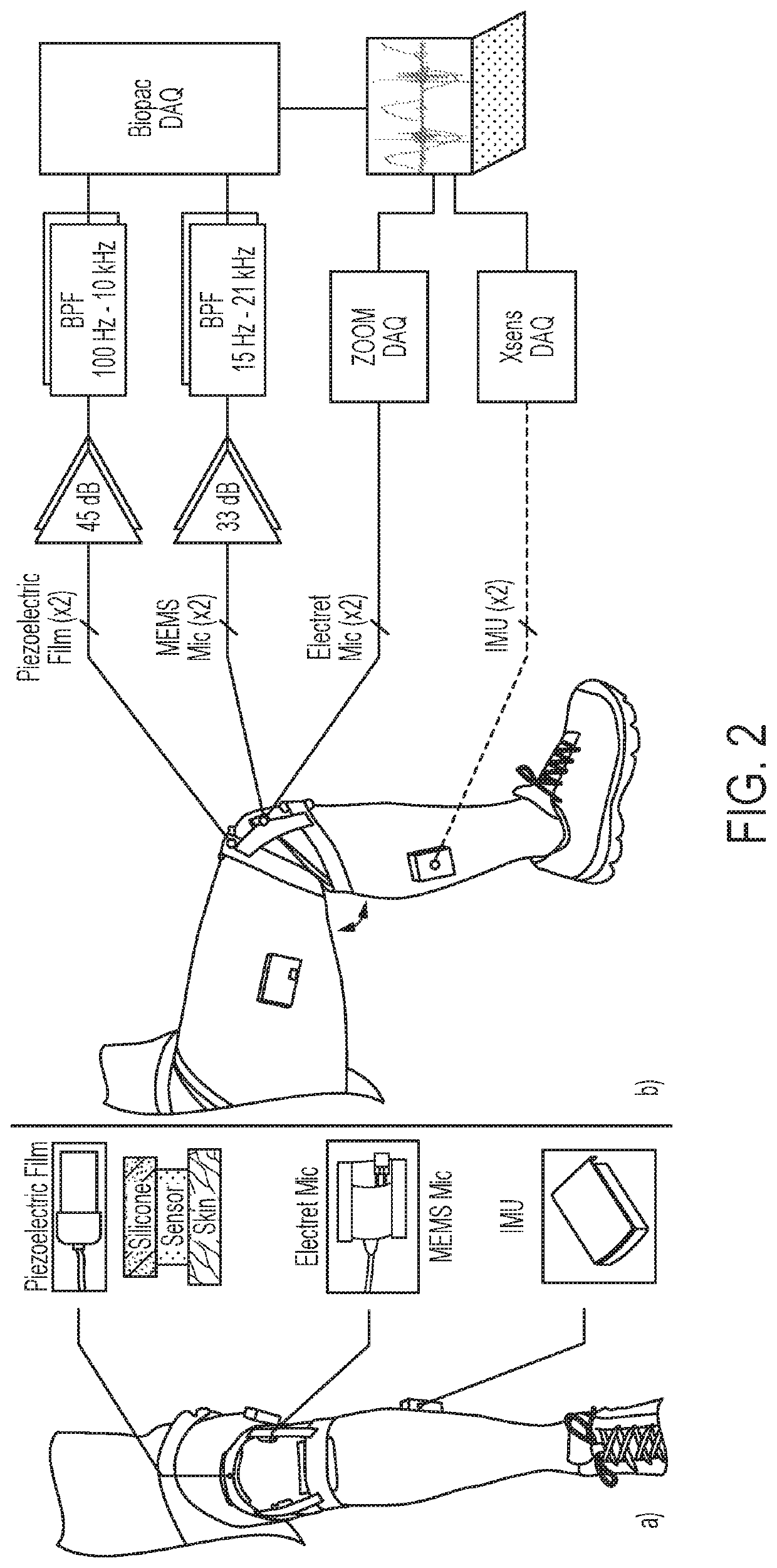 Wearable technologies for joint health assessment