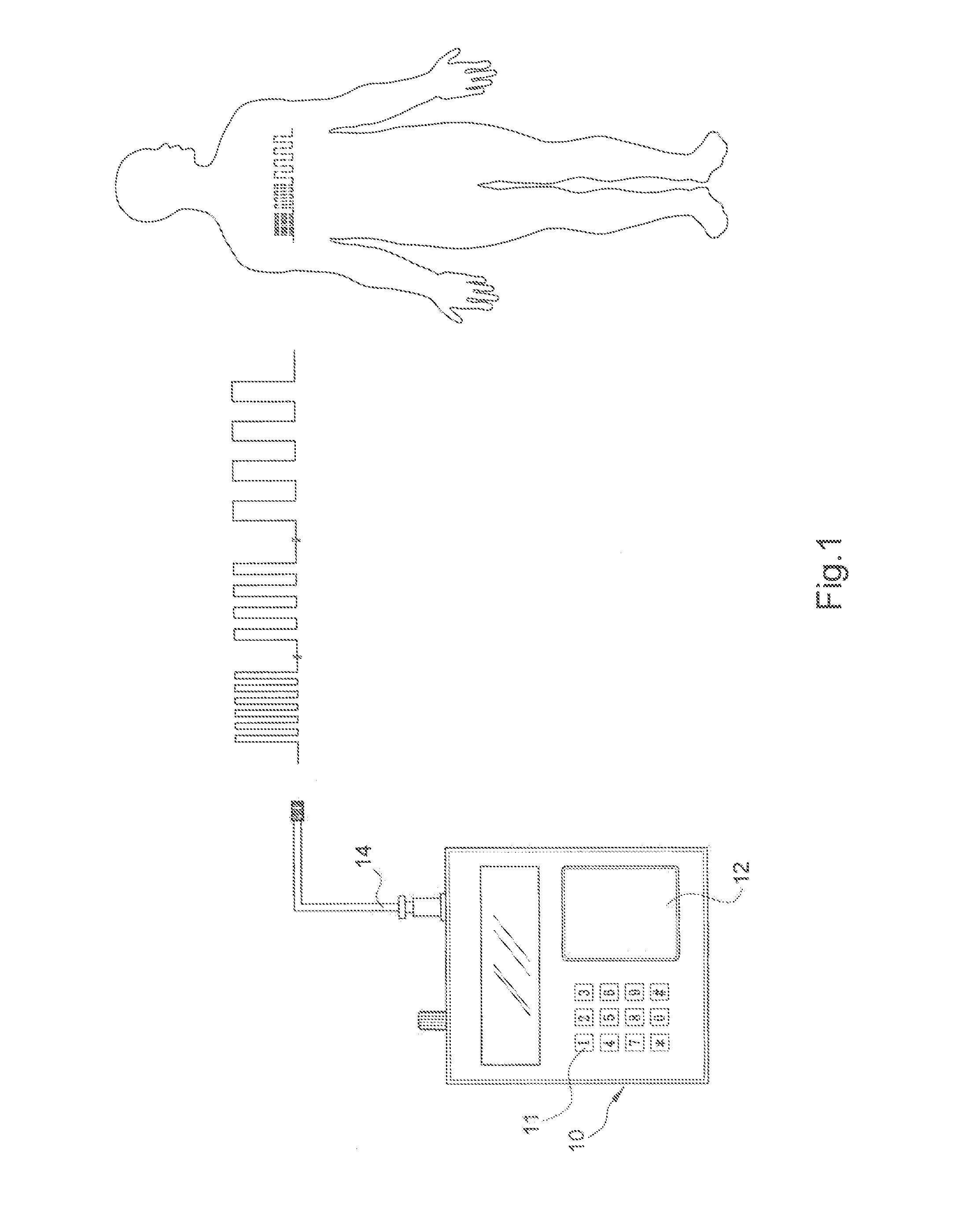 Diabetes glucagon mitigation system and method with an electrical energy wave generator