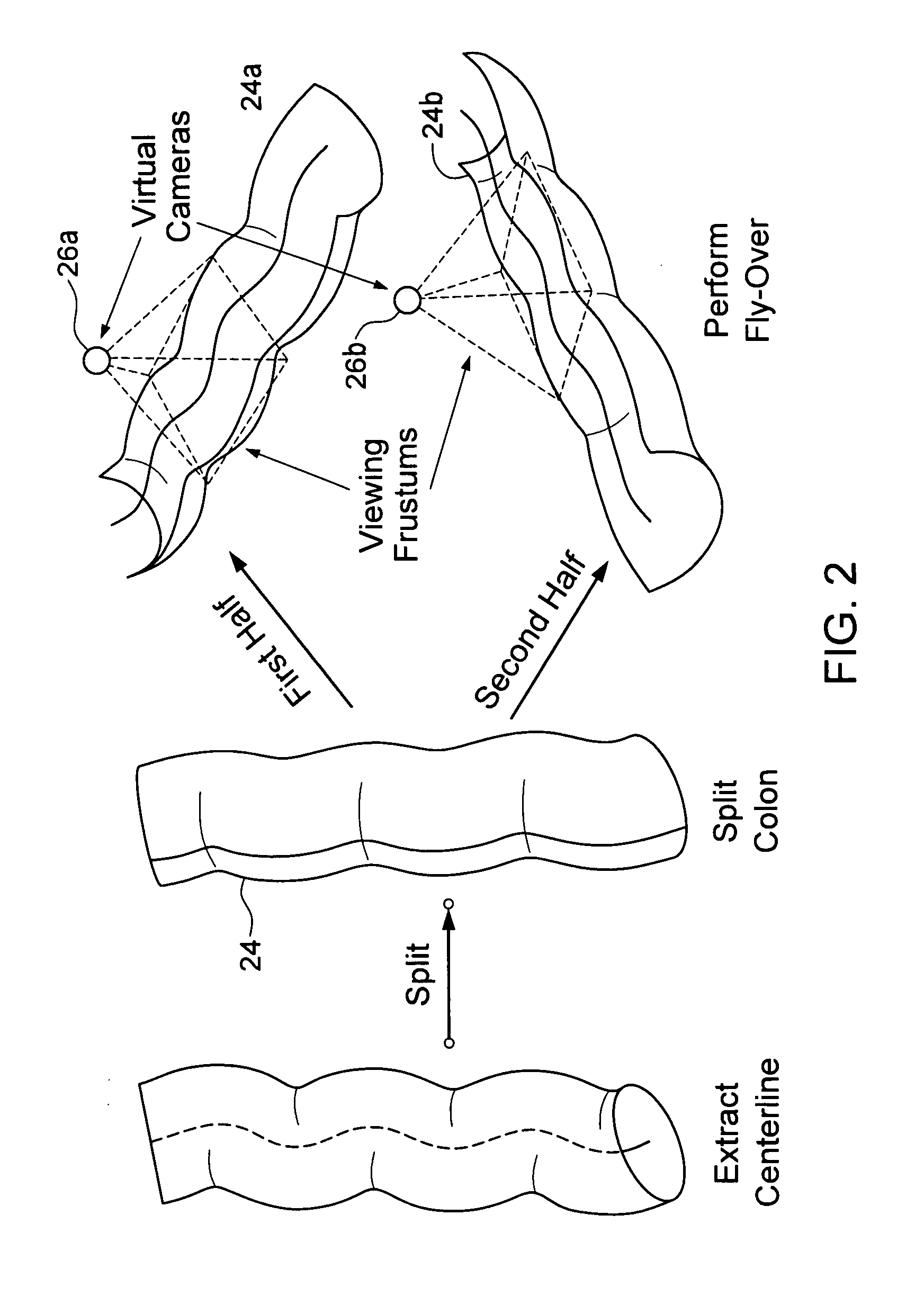 Virtual fly over of complex tubular anatomical structures