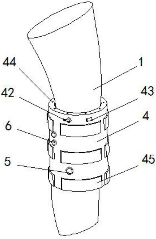 A self-adaptive fixation frame for lower extremity fracture care