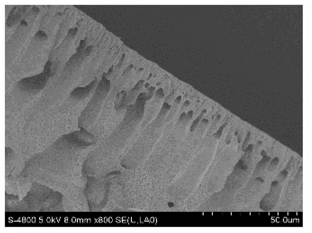 Ultrafiltration membrane with hydrophilism and antibacterial property and preparation method thereof