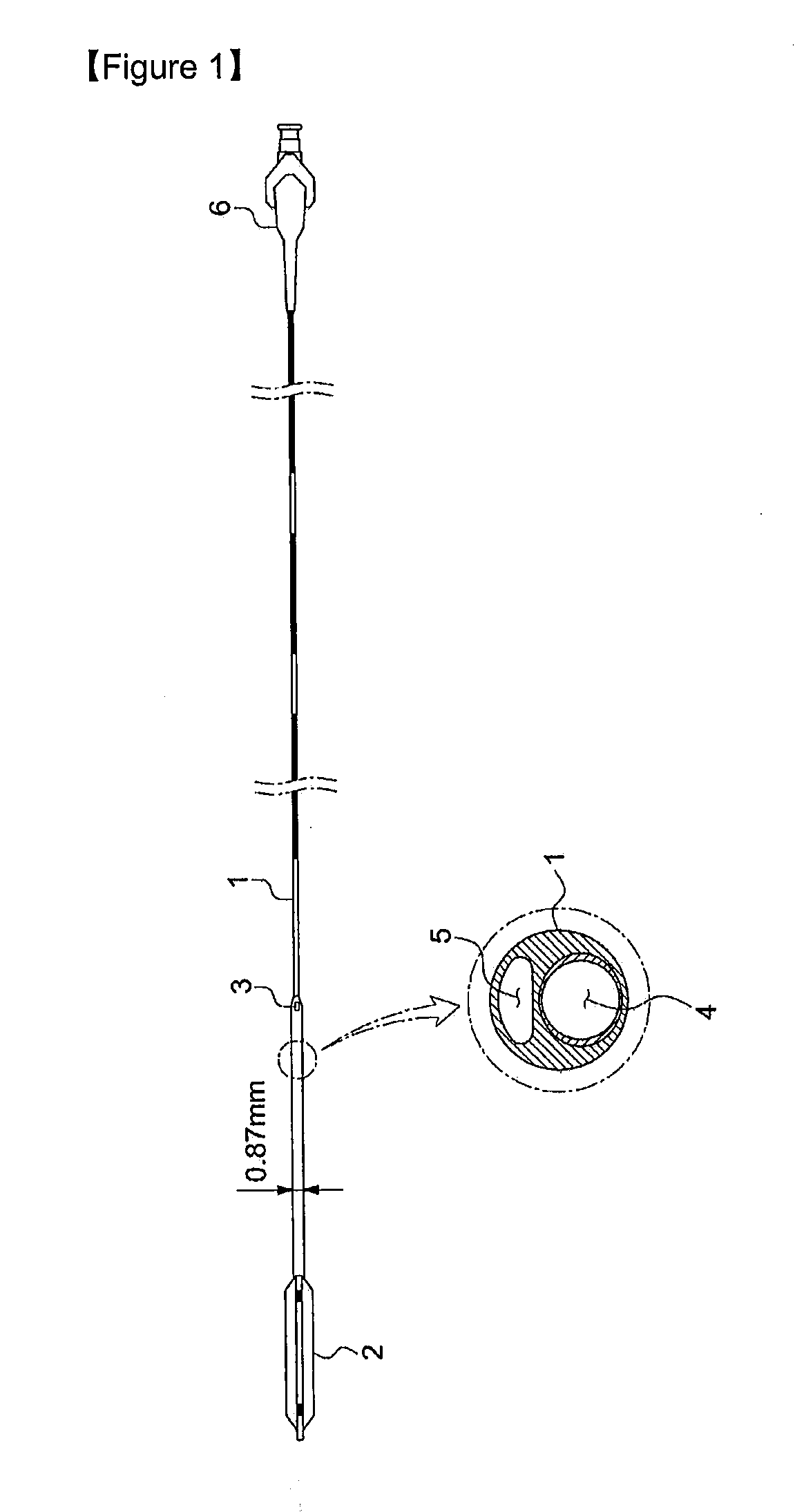 Balloon catheter