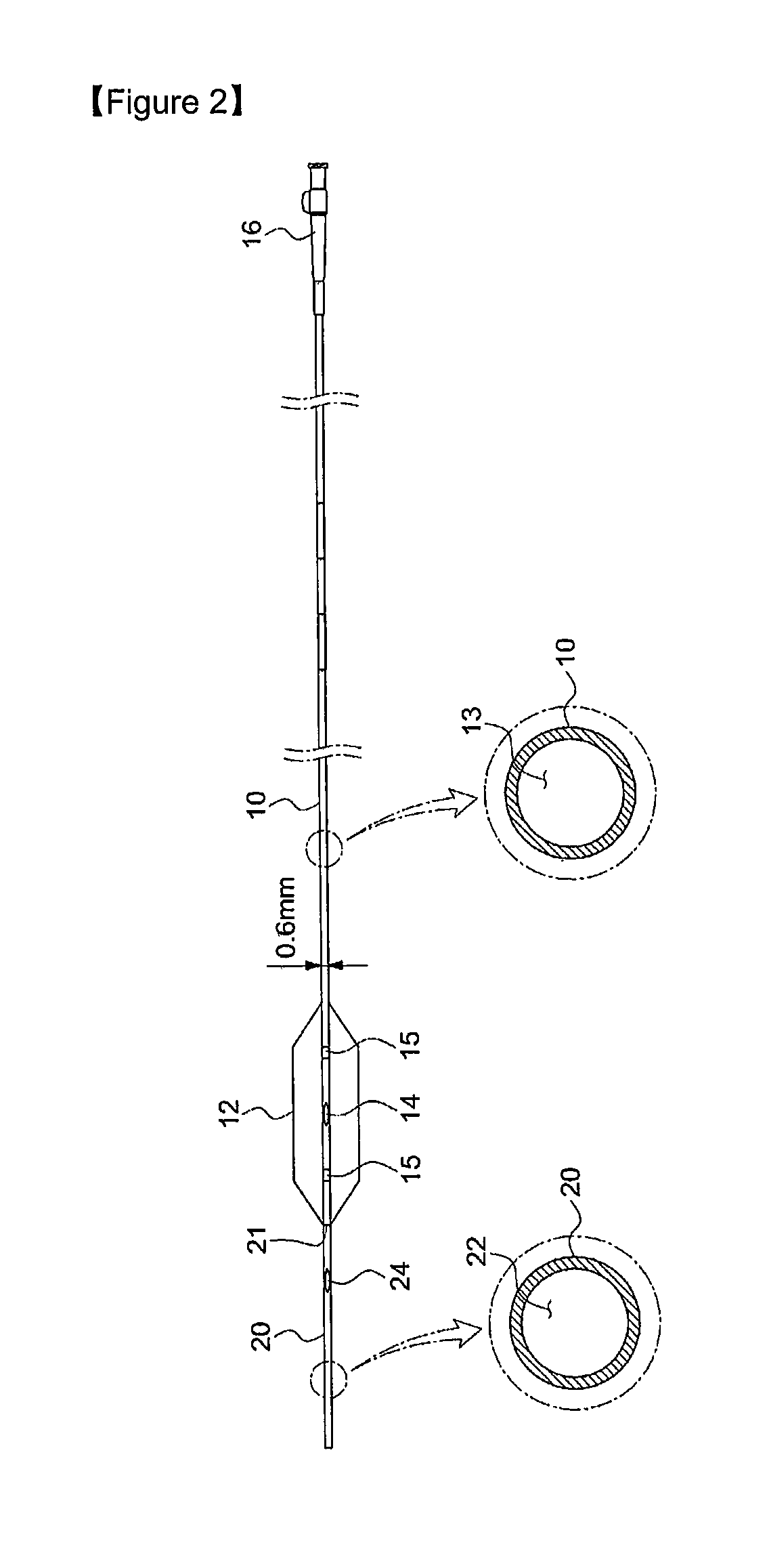 Balloon catheter