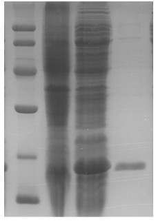 Recombinant soybean allergen, mutant and preparation methods and application of recombinant soybean allergen and mutant