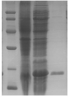 Recombinant soybean allergen, mutant and preparation methods and application of recombinant soybean allergen and mutant