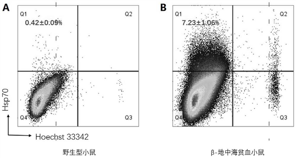 Application of HSP70 as molecular marker to detection of thalassemia and preparation of diagnostic kit