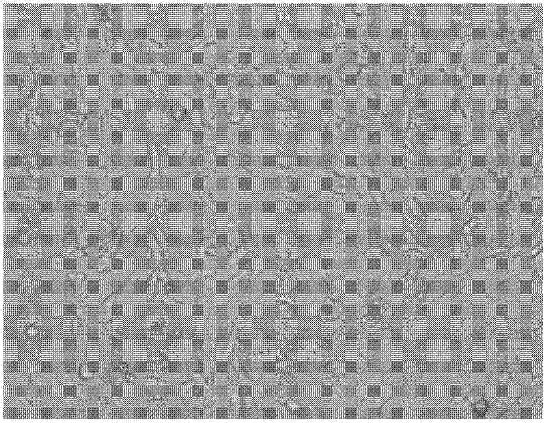 H1N1 subtype swine influenza virus and application thereof