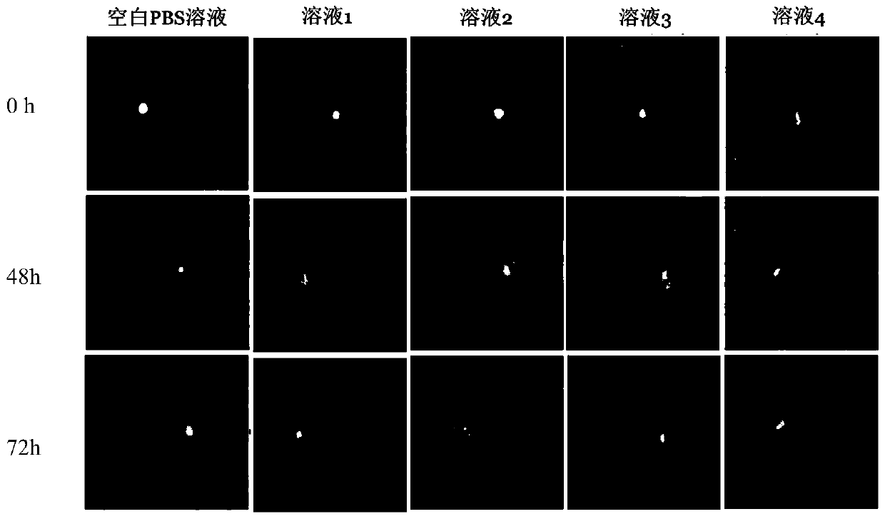 A kind of curcumin micellar nasal administration solution and preparation method thereof